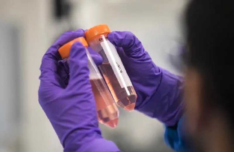 Simon Dawson/Bloomberg